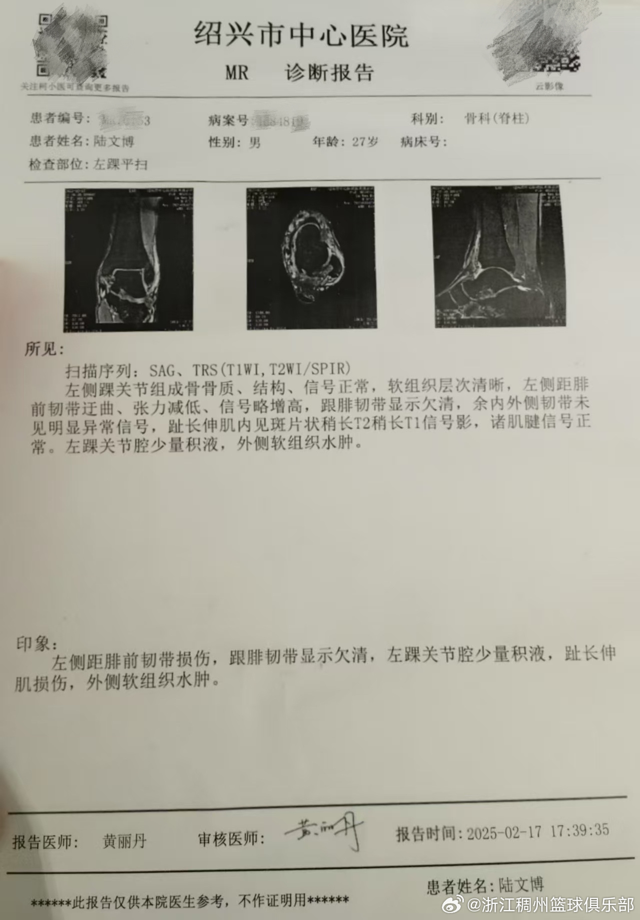 之间展开激